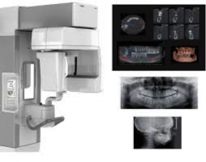 TC Cone Beam di ultima generazione